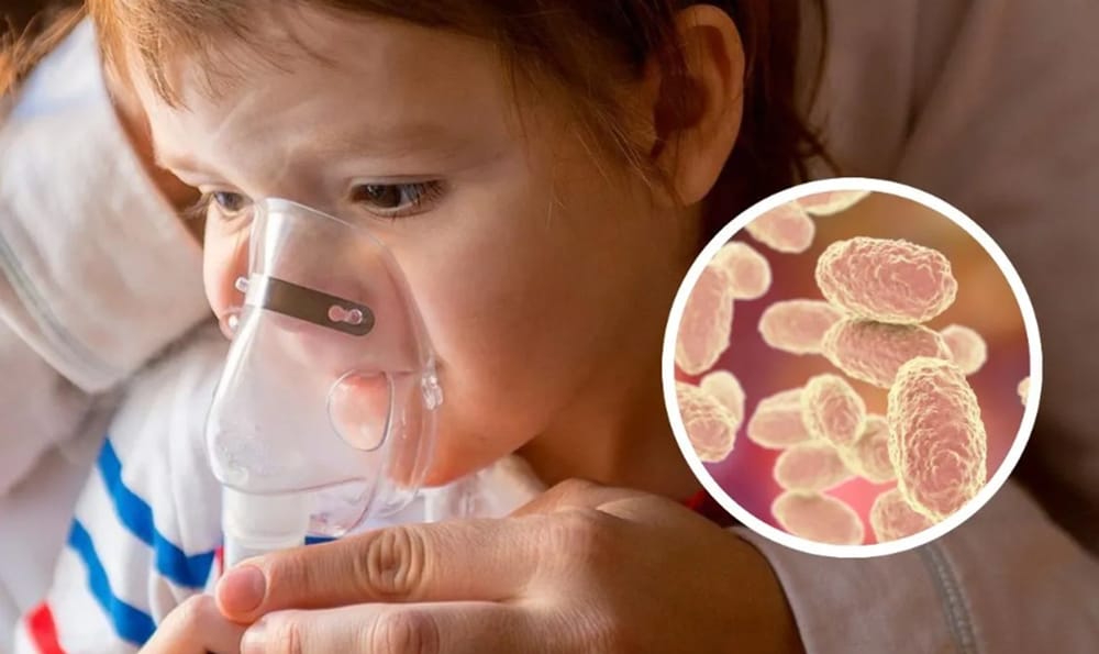 Preocupación en Santander por casos de tos ferina en niños de la comunidad indígena U’wa imagen de la publicación