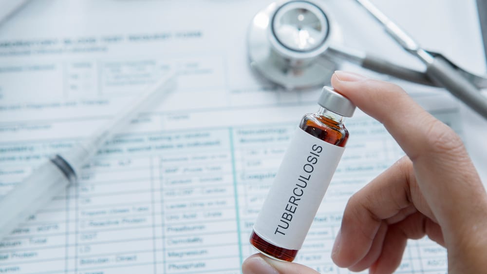 Vacuna centenaria contra la tuberculosis muestra resultados prometedores en pacientes con diabetes autoinmune imagen de la publicación
