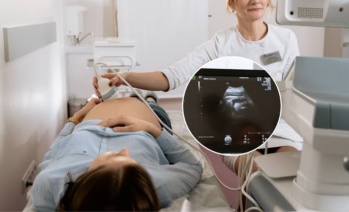 Chile debate proyecto que obligaría a escuchar los latidos del feto antes de un aborto legal imagen de la publicación