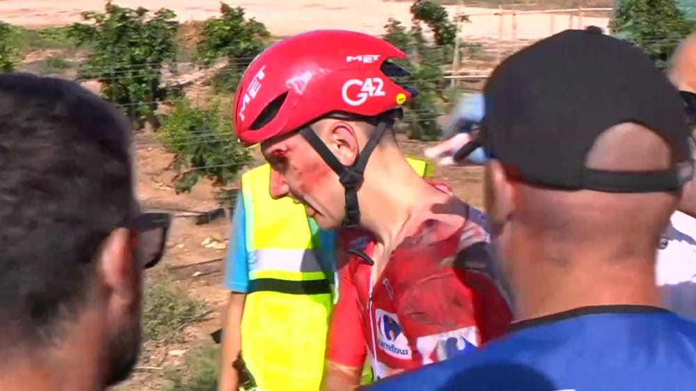 Tadej Pogačar abandona La Vuelta tras sufrir una dura caída y deja en suspenso su temporada imagen de la publicación