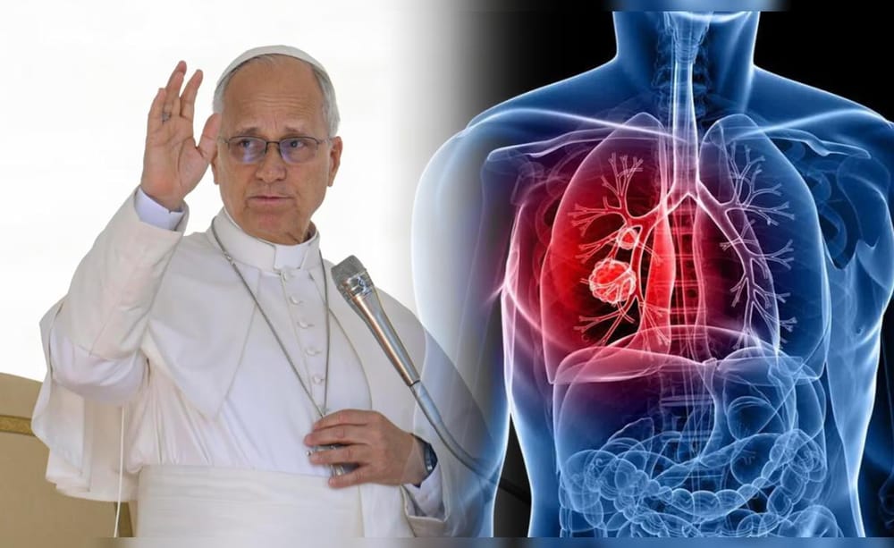 Qué es el adenocarcinoma pulmonar, el tumor maligno detectado al papa León XIV imagen de la publicación