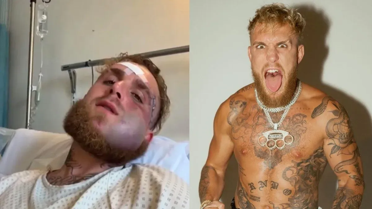 Jake Paul admite que podría no volver a pelear tras brutal fractura de mandíbula imagen de la publicación