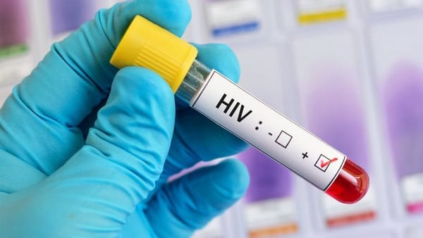 Científicos descubrieron un tratamiento que podría curar el VIH