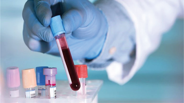 El revolucionario análisis de sangre que detecta cáncer en etapas tempranas