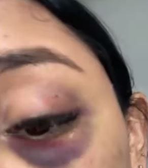 A cuchillo y puño limpio su ex casi la mata en Bucaramanga