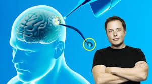 Neuralink se sobrepuso a su primer problema