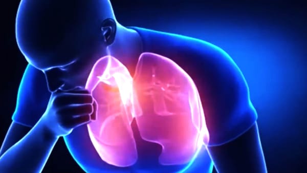 La tuberculosis vuelve a superar al COVID-19 en mortalidad global