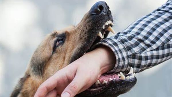 Perro mató a una mujer y mordió a dos policías