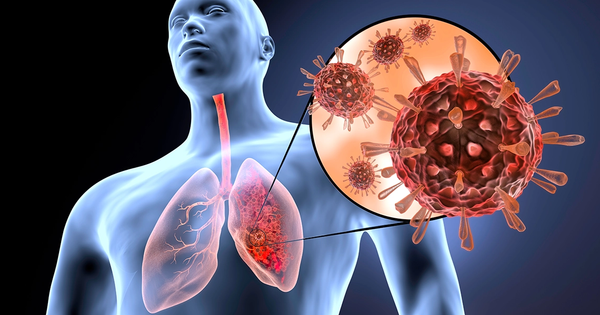 Aumentan infecciones respiratorias en Santander