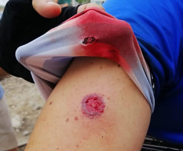 Adulto mayor defendió a un amigo y salió herido