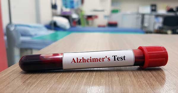 Validan prueba de sangre con más del 90% de precisión en detección precoz del Alzheimer