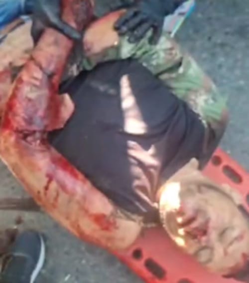 Motociclista sobrevivió tras caer debajo de las llantas de una turbo