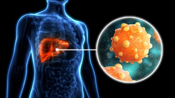 Hepatitis: la amenaza silenciosa que cobra una vida cada 30 segundos