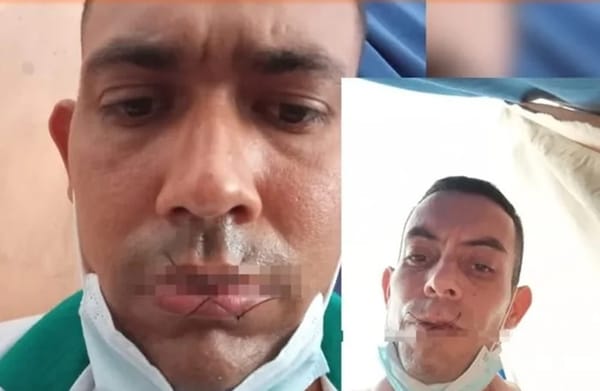 Protesta con bocas cosidas en cárcel de Pologordo en Girón